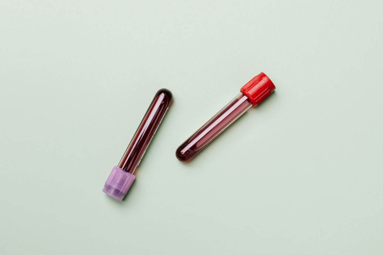 Blood Tests
